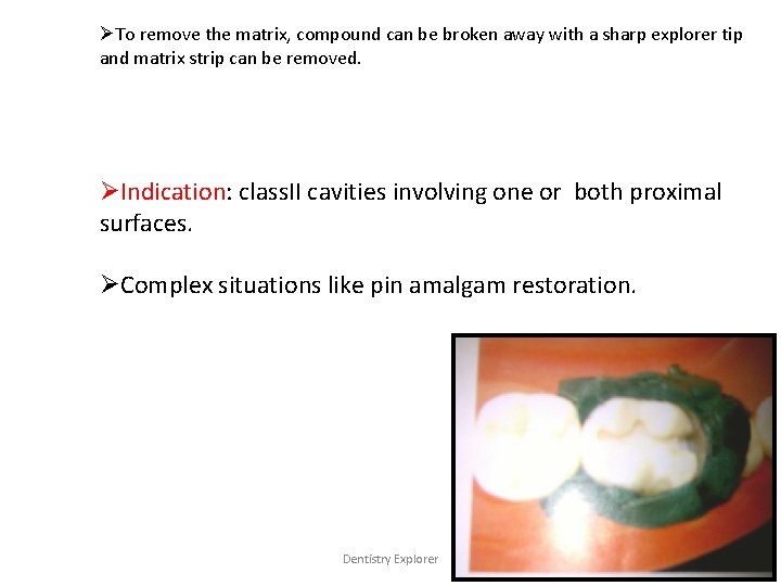 ØTo remove the matrix, compound can be broken away with a sharp explorer tip
