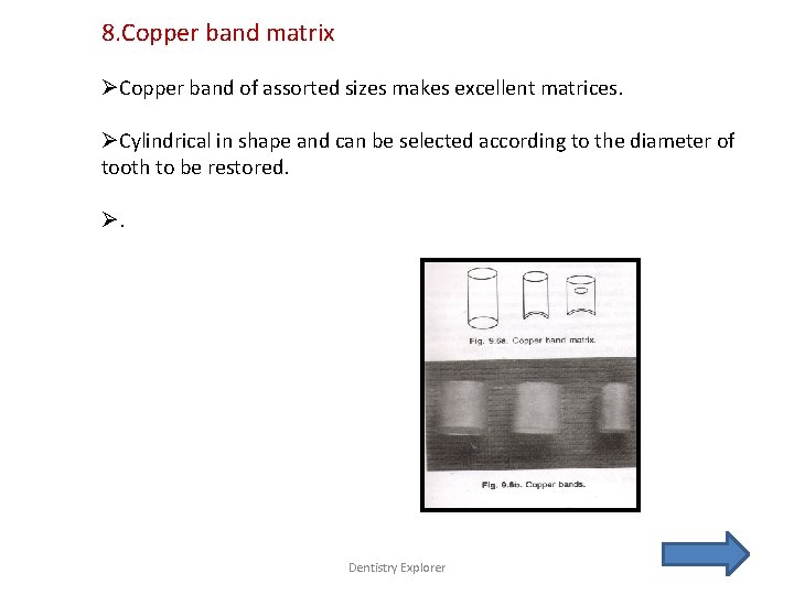 8. Copper band matrix ØCopper band of assorted sizes makes excellent matrices. ØCylindrical in
