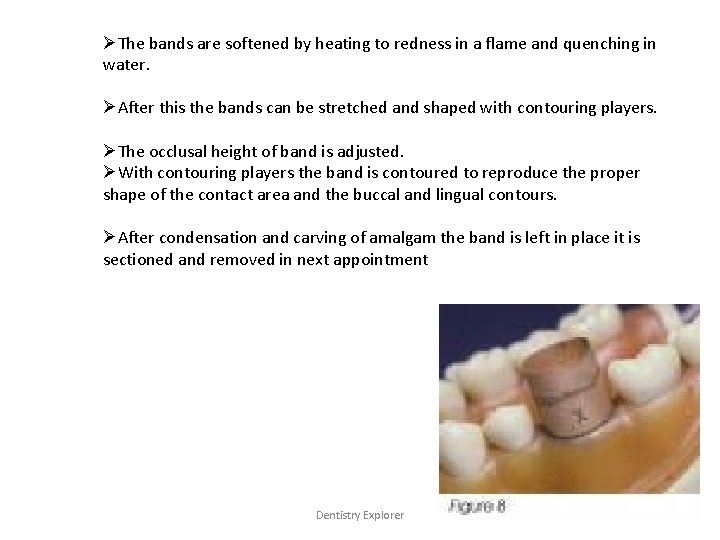 ØThe bands are softened by heating to redness in a flame and quenching in