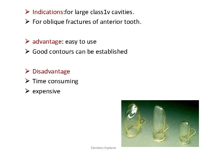 Ø Indications: for large class 1 v cavities. Ø For oblique fractures of anterior
