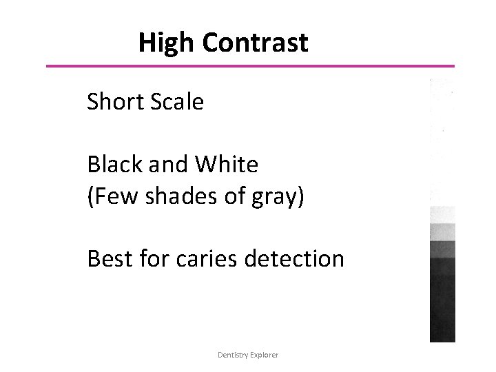 High Contrast Short Scale Black and White (Few shades of gray) Best for caries