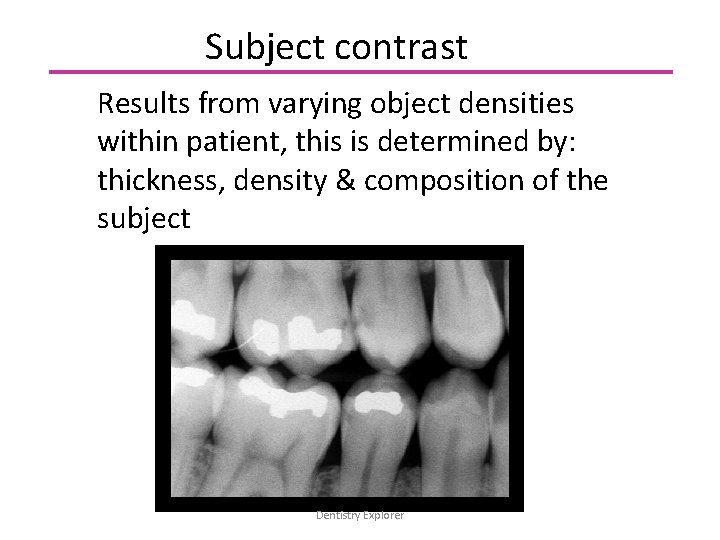 Subject contrast Results from varying object densities within patient, this is determined by: thickness,