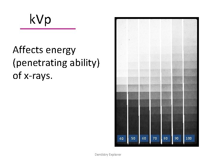 k. Vp Affects energy (penetrating ability) of x-rays. 40 Dentistry Explorer 50 60 70