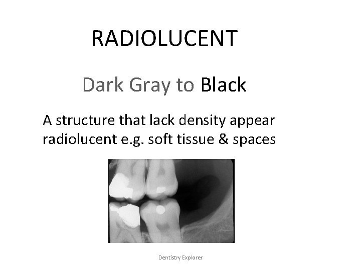 RADIOLUCENT Dark Gray to Black A structure that lack density appear radiolucent e. g.