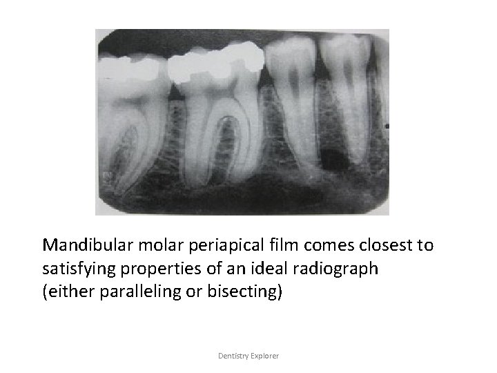Mandibular molar periapical film comes closest to satisfying properties of an ideal radiograph (either