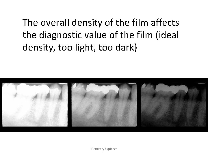 The overall density of the film affects the diagnostic value of the film (ideal