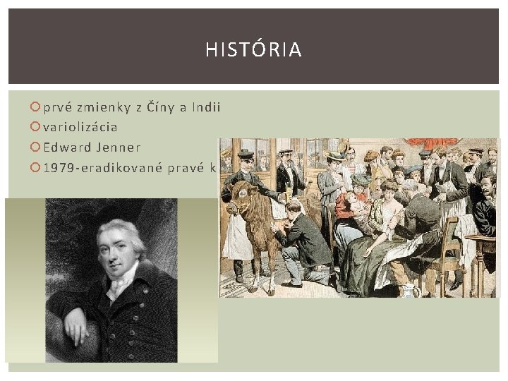 HISTÓRIA prvé zmienky z Číny a Indii variolizácia Edward Jenner 1979 -eradikované pravé kiahne