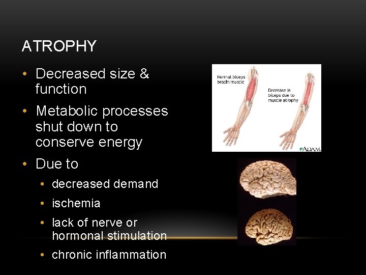 ATROPHY • Decreased size & function • Metabolic processes shut down to conserve energy