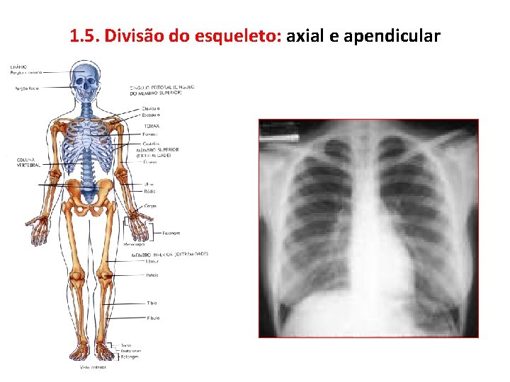 1. 5. Divisão do esqueleto: axial e apendicular 