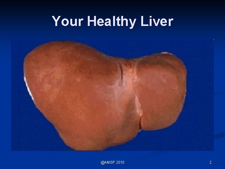 Your Healthy Liver @AMSP 2010 2 