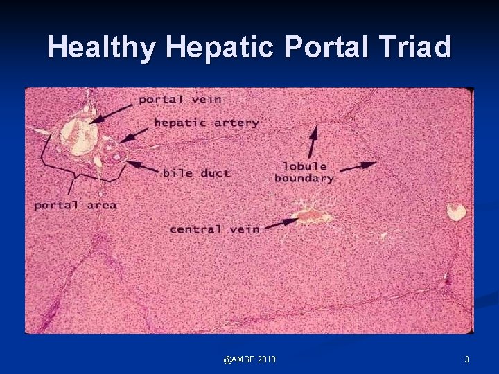 Healthy Hepatic Portal Triad @AMSP 2010 3 