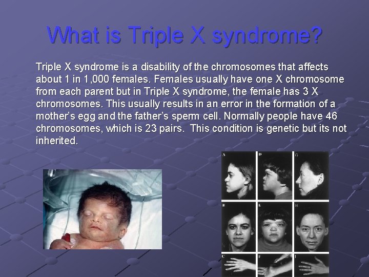 What is Triple X syndrome? Triple X syndrome is a disability of the chromosomes What is Triple X syndrome? Triple X syndrome is a disability of the chromosomes