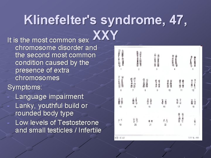 Klinefelter's syndrome, 47, It is the most common sex XXY chromosome disorder and the Klinefelter's syndrome, 47, It is the most common sex XXY chromosome disorder and the