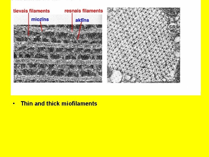  • Thin and thick miofilaments 