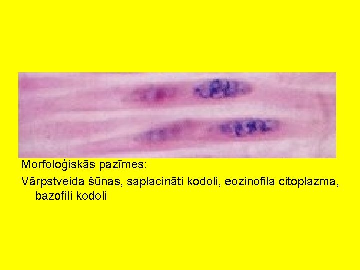 Morfoloģiskās pazīmes: Vārpstveida šūnas, saplacināti kodoli, eozinofila citoplazma, bazofili kodoli 