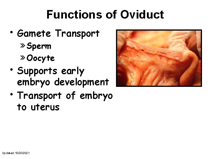 Functions of Oviduct • Gamete » Sperm » Oocyte Transport • Supports • early