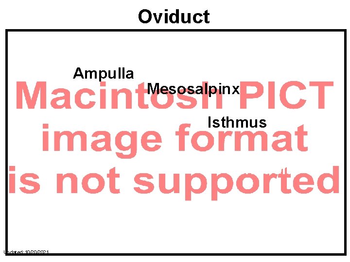Oviduct Ampulla Mesosalpinx Isthmus UT Junction Uterine Horn Updated: 10/20/2021 