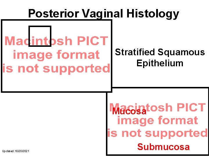 Posterior Vaginal Histology Stratified Squamous Epithelium Mucosa Updated: 10/20/2021 Submucosa 