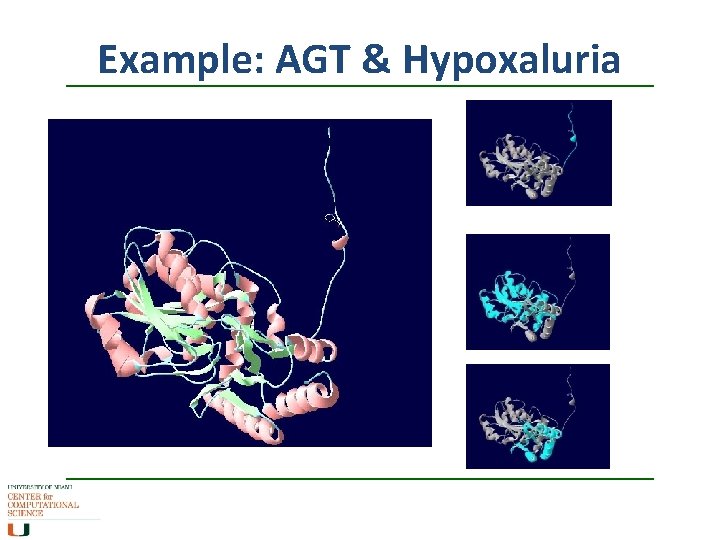 Example: AGT & Hypoxaluria Example: AGT & Hypoxaluria