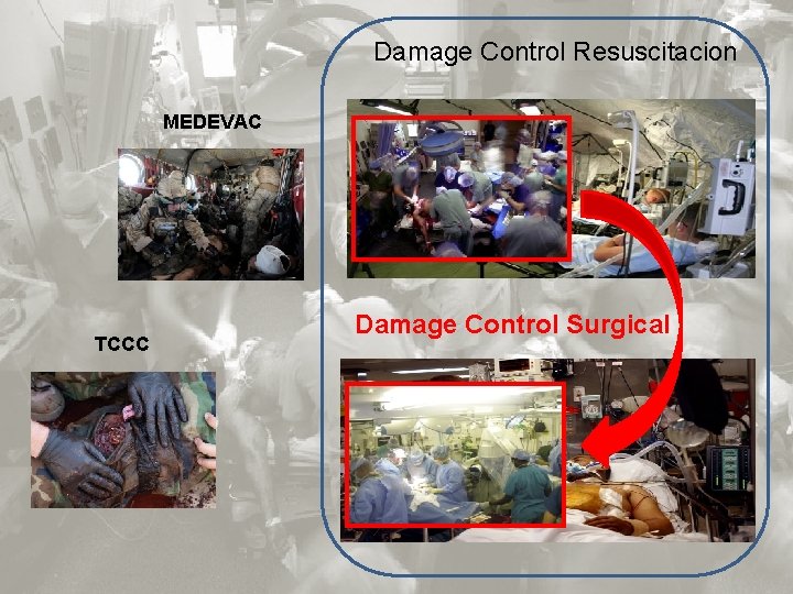 Damage Control Resuscitacion MEDEVAC TCCC Damage Control Surgical 