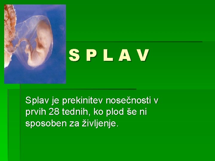 SPLAV Splav je prekinitev nosečnosti v prvih 28 tednih, ko plod še ni sposoben