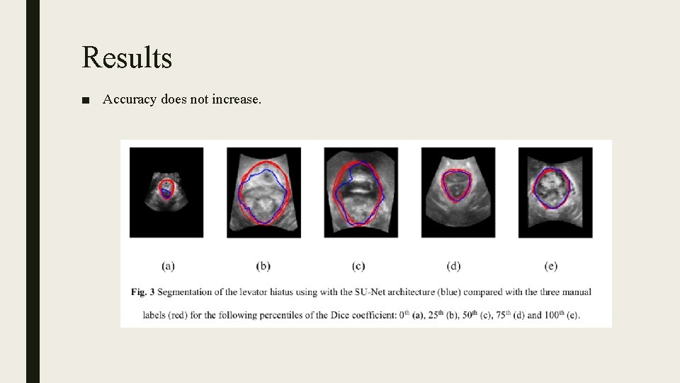 Results ■ Accuracy does not increase. 