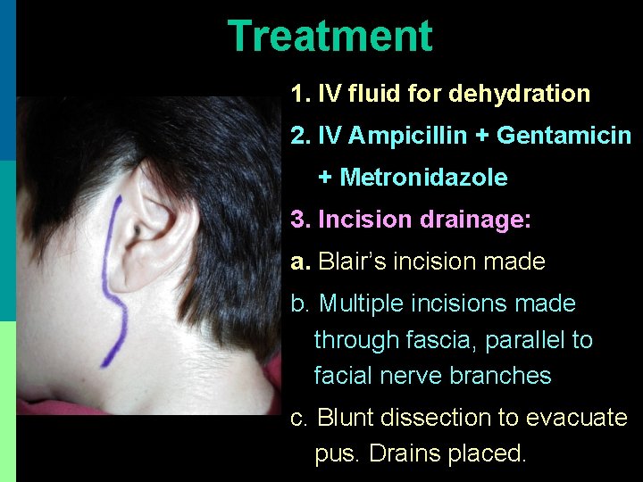 Treatment 1. IV fluid for dehydration 2. IV Ampicillin + Gentamicin + Metronidazole 3.