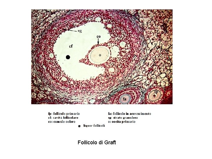 Follicolo di Graft 