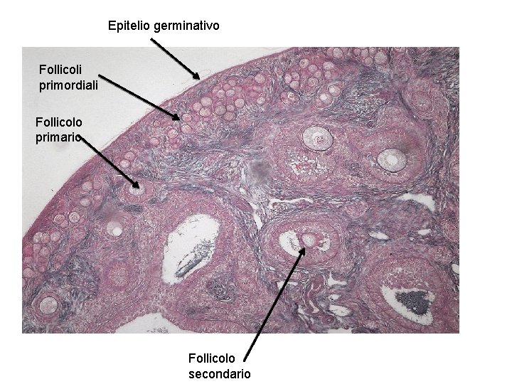 Epitelio germinativo Follicoli primordiali Follicolo primario Follicolo secondario 