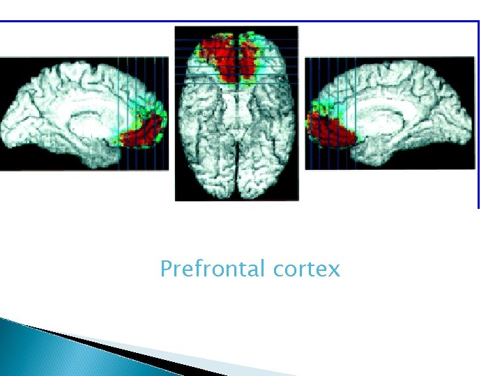 Prefrontal cortex 