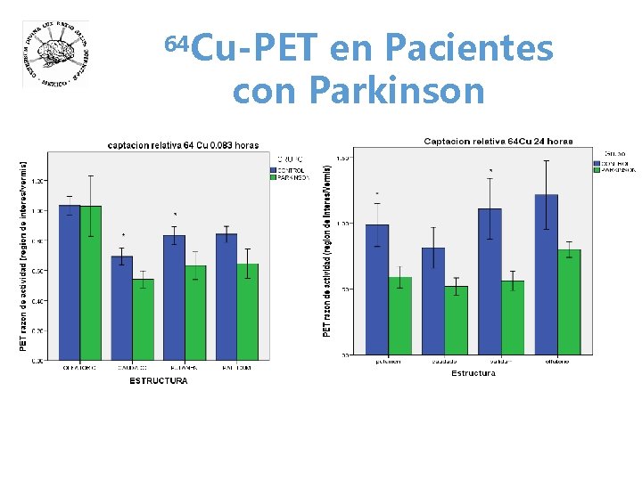 64 Cu-PET en Pacientes con Parkinson 