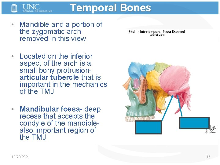 Temporal Bones • Mandible and a portion of the zygomatic arch removed in this