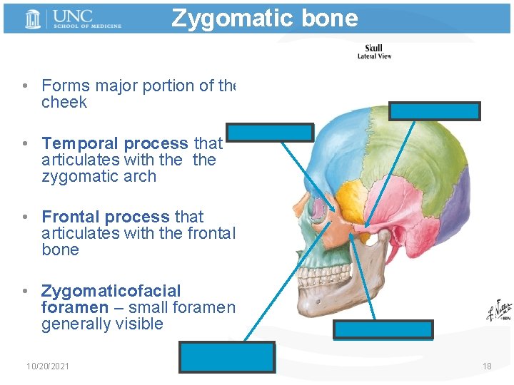 Zygomatic bone • Forms major portion of the cheek • Temporal process that articulates