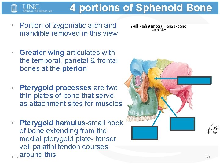 4 portions of Sphenoid Bone • Portion of zygomatic arch and mandible removed in