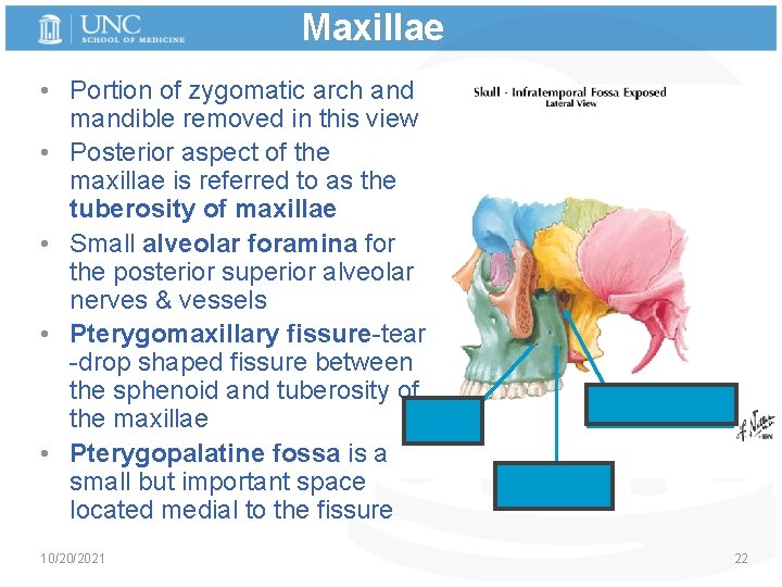 Maxillae • Portion of zygomatic arch and mandible removed in this view • Posterior