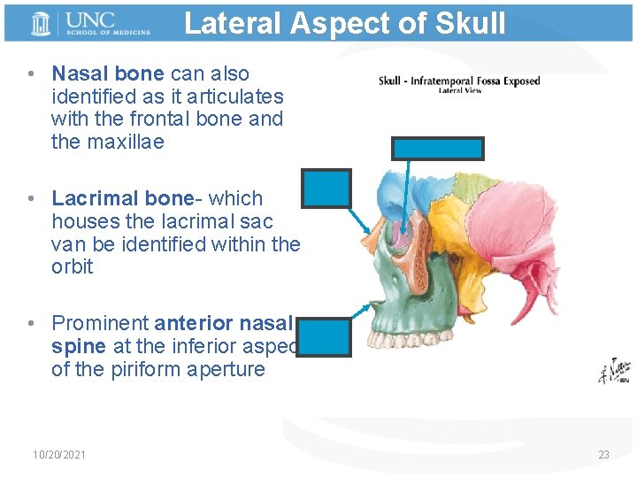 Lateral Aspect of Skull • Nasal bone can also identified as it articulates with