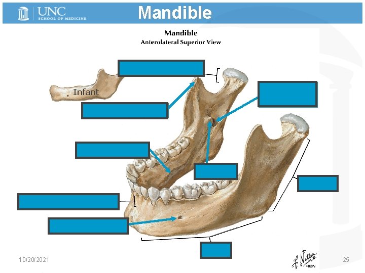 Mandible Condylar Process Mandibular foramen Infant Coronoid process Mylohyoid line Lingula Ramus Alveolar Part