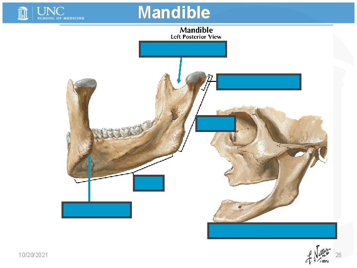 Mandible Mandibular notch Condylar process Ramus Body Mental spines Bone loss due to tooth