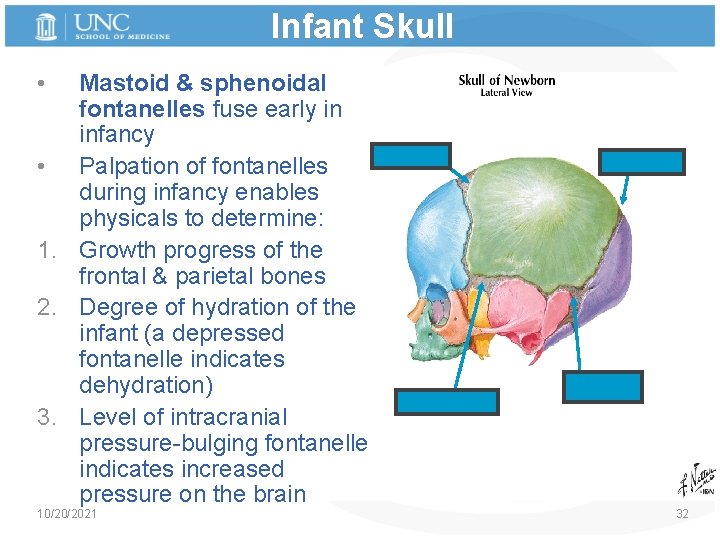 Infant Skull • Mastoid & sphenoidal fontanelles fuse early in infancy • Palpation of