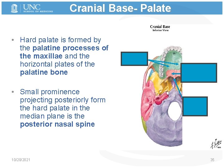Cranial Base- Palate • Hard palate is formed by the palatine processes of the