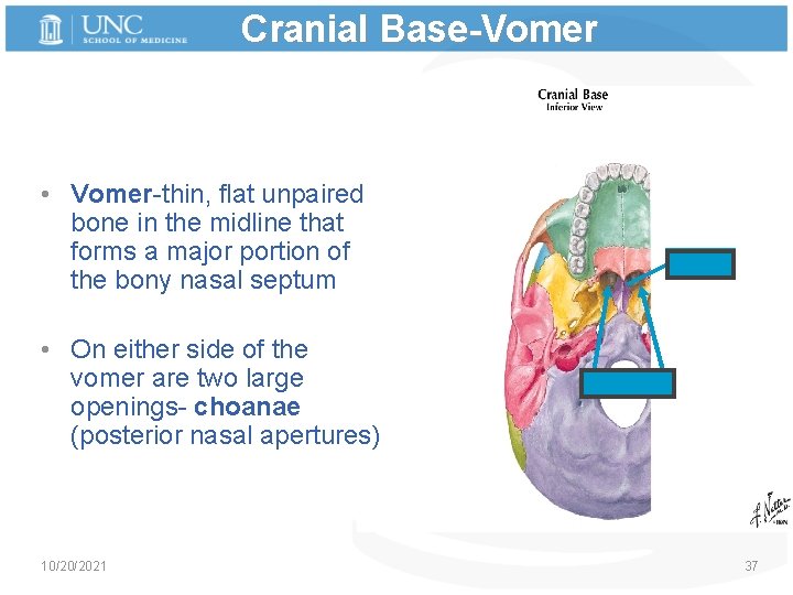 Cranial Base-Vomer • Vomer-thin, flat unpaired bone in the midline that forms a major