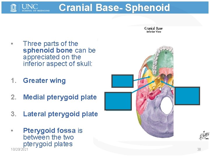 Cranial Base- Sphenoid • Three parts of the sphenoid bone can be appreciated on