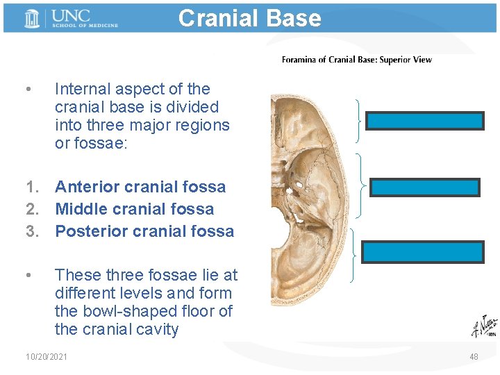 Cranial Base • Internal aspect of the cranial base is divided into three major