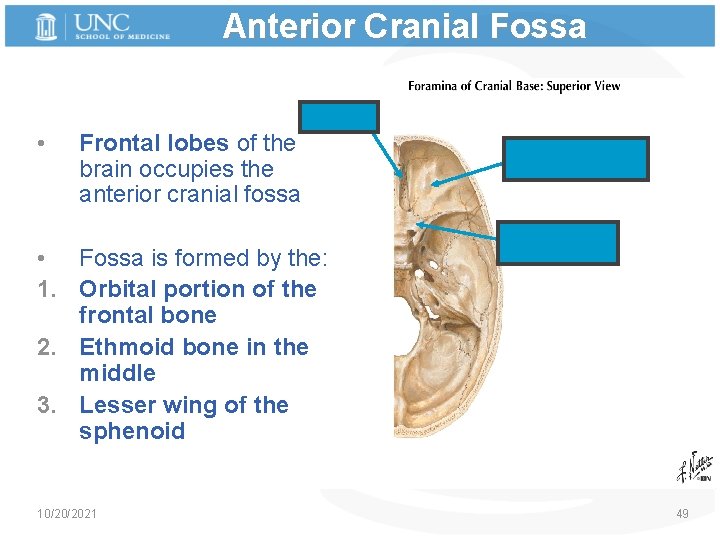 Anterior Cranial Fossa Ethmoid • Frontal lobes of the brain occupies the anterior cranial