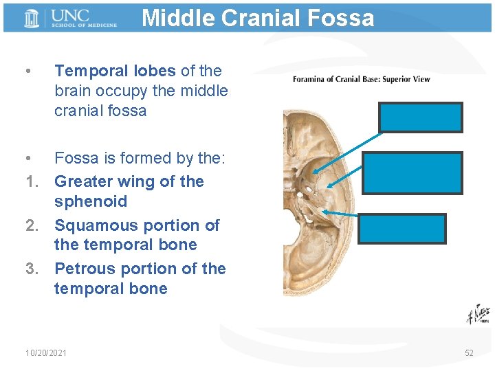 Middle Cranial Fossa • Temporal lobes of the brain occupy the middle cranial fossa