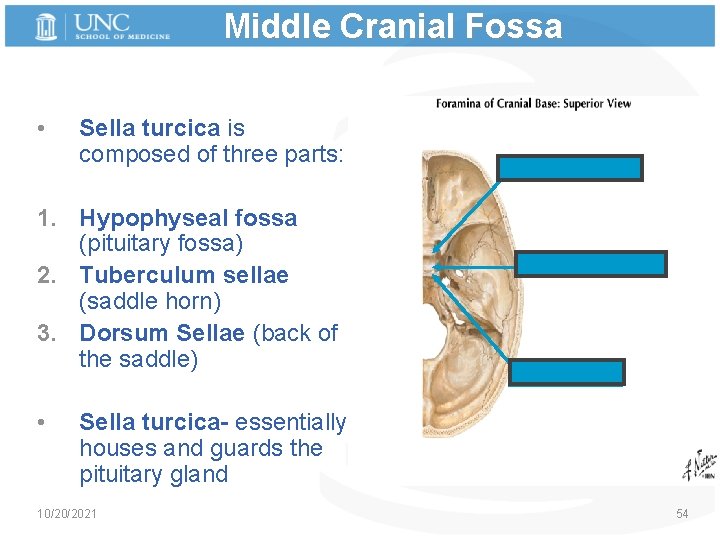 Middle Cranial Fossa • Sella turcica is composed of three parts: 1. Hypophyseal fossa