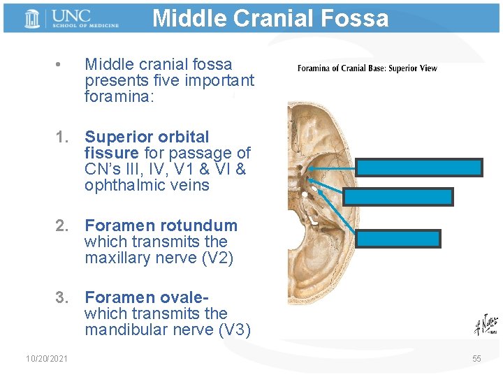 Middle Cranial Fossa • Middle cranial fossa presents five important foramina: 1. Superior orbital