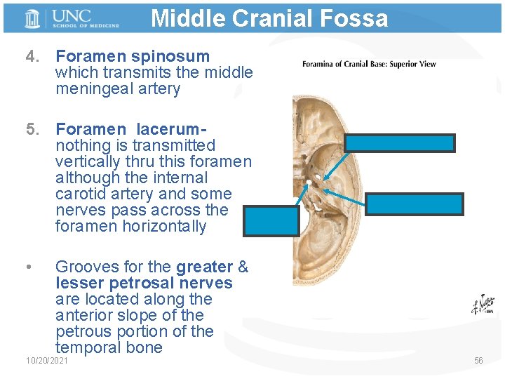 Middle Cranial Fossa 4. Foramen spinosum which transmits the middle meningeal artery 5. Foramen