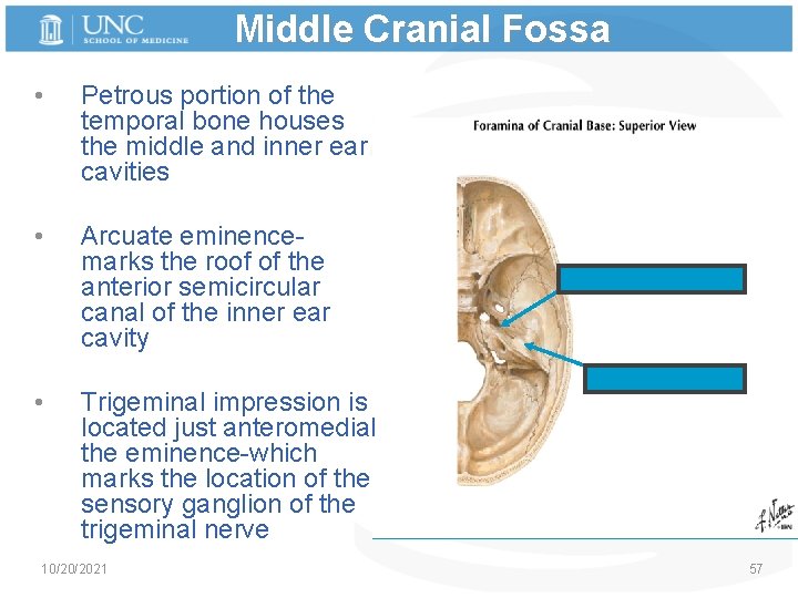 Middle Cranial Fossa • Petrous portion of the temporal bone houses the middle and