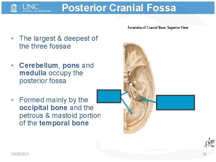 Posterior Cranial Fossa • The largest & deepest of the three fossae • Cerebellum,